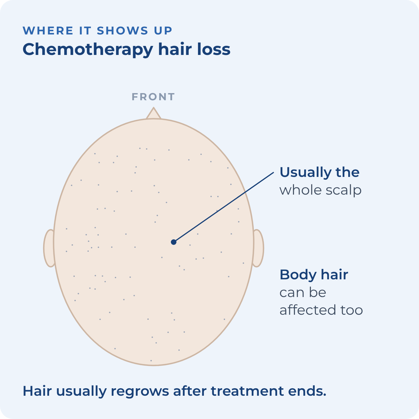 Top view of the scalp with almost all hair lost
