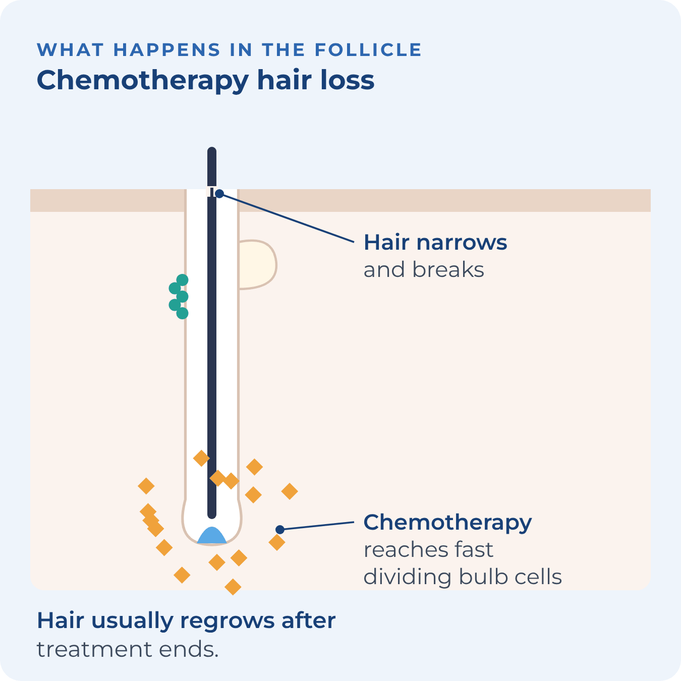Chemotherapy reaches the dividing cells of the hair bulb and the hair thins and breaks